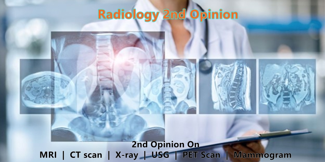 Radiology 2nd Opinion